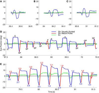 A GABAergic Dysfunction in the Olivary–Cerebellar–Brainstem Network May Cause Eye Oscillations and Body Tremor. II. Model Simulations of Saccadic Eye Oscillations